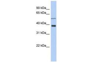Image no. 1 for anti-Synovial Sarcoma Translocation Gene On Chromosome 18-Like 1 (SS18L1) (AA 251-300) antibody (ABIN6743926) (SS18L1 anticorps  (AA 251-300))