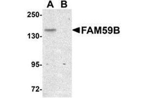Western blot analysis of FAM59B in SK-N-SH cell lysate with AP30331PU-N FAM59B antibody at 1 μg/ml in (A) the absence and (B) the presence of blocking peptide. (FAM59B anticorps  (C-Term))