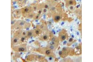 Used in DAB staining on fromalin fixed paraffin-embedded Liver tissue