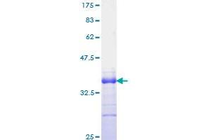 Image no. 1 for Jagged 1 (JAG1) (AA 531-620) protein (GST tag) (ABIN1308267)