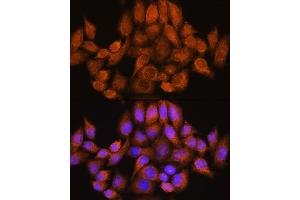 Immunofluorescence analysis of HeLa cells using  Rabbit pAb (ABIN7269965) at dilution of 1:100. (ARHGAP30 anticorps  (AA 485-585))