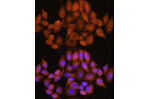 Immunofluorescence analysis of HeLa cells using  Rabbit pAb (ABIN7269965) at dilution of 1:100. (ARHGAP30 anticorps  (AA 485-585))