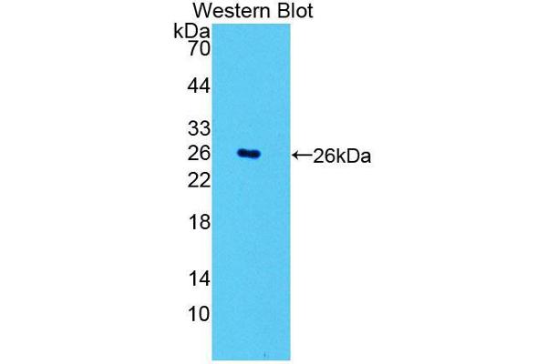 POMT1 anticorps  (AA 318-513)