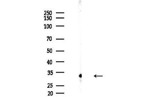 anti-Ribosomal Protein S2 (RPS2) (C-Term) antibody
