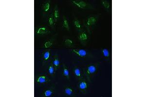 Immunofluorescence analysis of H9C2 cells using NBAS Rabbit pAb (ABIN1680973, ABIN3019188, ABIN3019189 and ABIN6220752) at dilution of 1:100. (NBAS anticorps  (AA 1-70))
