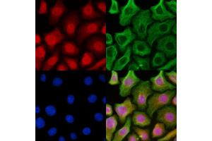 ABIN6262651 and ABIN6269358 staining HepG2 cells by IF/ICC.