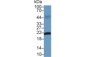 Detection of FTH in Rat Cerebrum lysate using Polyclonal Antibody to Ferritin, Heavy Polypeptide (FTH)