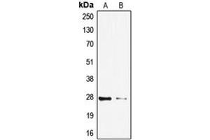 Western blot analysis of TP53INP1 expression in HeLa (A), HepG2 (B) whole cell lysates. (TP53INP1 anticorps  (C-Term))