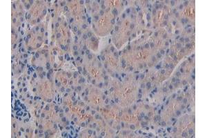 Detection of ITGb3 in Mouse Kidney Tissue using Polyclonal Antibody to Integrin Beta 3 (ITGb3) (Integrin beta 3 anticorps  (AA 134-376))