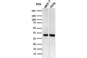 Western Blot Analysis of Human MCF-7, T47D cell lysates using RPA2 Recombinant Rabbit Monoclonal Antibody (RPA2/3140R). (Recombinant RPA2 anticorps)