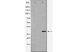 Western blot analysis of SIRT3 expression in Mouse Heart lysate,The lane on the left is treated with the antigen-specific peptide. (SIRT3 anticorps  (C-Term))