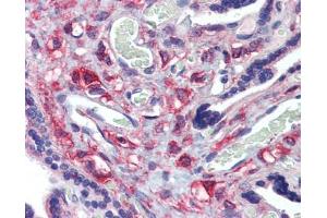 KIF20A antibody was used for immunohistochemistry at a concentration of 4-8 ug/ml.