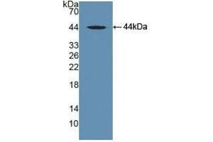 Detection of Recombinant DBP, Human using Polyclonal Antibody to Vitamin D Binding Protein (DBP) (Vitamin D-Binding Protein anticorps  (AA 395-474))