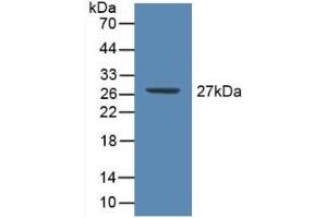 Detection of Recombinant CRP, Human using Polyclonal Antibody to C Reactive Protein (CRP) (CRP anticorps  (AA 17-224))