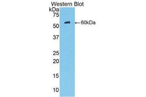 Western Blotting (WB) image for anti-Mannose-Binding Lectin (Protein C) 2, Soluble (MBL2) (AA 130-248) antibody (ABIN3206585) (MBL2 anticorps  (AA 130-248))