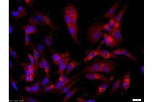 U251 cells (human glioma cells) were probed with Rabbit Anti-CASPR/Neurexin4 Polyclonal Antibody, Unconjugatedused at 1:200 dilution for 40 minutes at 37°C