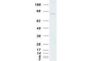 Validation with Western Blot