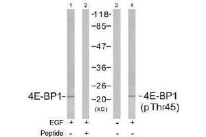 Image no. 2 for anti-Eukaryotic Translation Initiation Factor 4E Binding Protein 1 (EIF4EBP1) (pThr45) antibody (ABIN196966) (eIF4EBP1 anticorps  (pThr45))