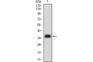 Western blot analysis using PLXNA1 mAb against human PLXNA1 (AA: 1100-1200) recombinant protein. (Plexin A1 anticorps  (AA 1100-1200))