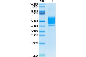 Mouse PSCA on Tris-Bis PAGE under reduced condition. (PSCA Protein (AA 21-95) (Fc Tag))
