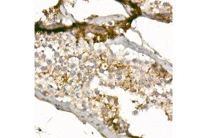 Immunohistochemistry of paraffin-embedded human testis using CD99 Rabbit pAb (ABIN3022730, ABIN3022731, ABIN3022732, ABIN1512728 and ABIN6219199) at dilution of 1:50 (40x lens).
