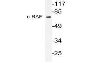Western blot (WB) analyzes of c-RAF antibody in extracts from K562 cells. (RAF1 anticorps)