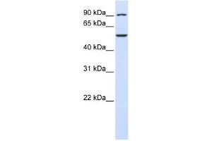 WDR34 antibody used at 1 ug/ml to detect target protein. (WDR34 anticorps  (C-Term))