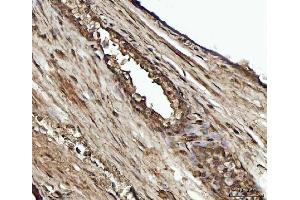 IHC analysis of YWHAE using anti-YWHAE antibody (ABIN7600163). (YWHAE anticorps  (AA 16-163))