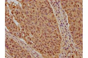 anti-Karyopherin (Importin) beta 1 (KPNB1) (AA 9-214) antibody