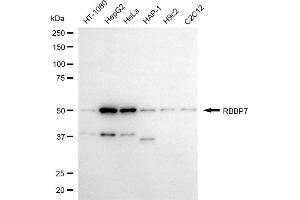 anti-Retinoblastoma Binding Protein 7 (RBBP7) antibody