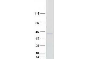 Validation with Western Blot