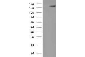 Western Blotting (WB) image for anti-Histone Deacetylase 6 (HDAC6) antibody (ABIN1498621) (HDAC6 anticorps)