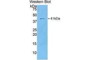 Western blot analysis of the recombinant protein. (CCL22 anticorps  (AA 25-93))