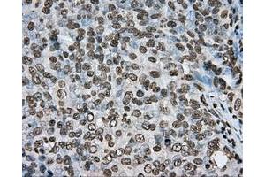 Immunohistochemical staining of paraffin-embedded colon tissue using anti-ARNTL mouse monoclonal antibody.