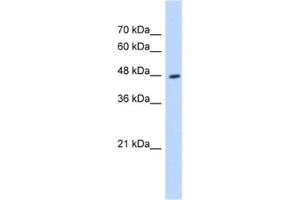Western Blotting (WB) image for anti-Hydroxyacyl-CoA Dehydrogenase/3-Ketoacyl-CoA Thiolase/enoyl-CoA Hydratase (Trifunctional Protein), beta Subunit (HADHB) antibody (ABIN2463135) (HADHB anticorps)