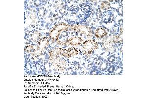 Rabbit Anti-PPP1R8 Antibody  Paraffin Embedded Tissue: Human Kidney Cellular Data: Epithelial cells of renal tubule Antibody Concentration: 4. (PPP1R8 anticorps  (Middle Region))