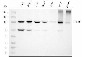 Western blot analysis of MCM6 using anti-MCM6 antibody (ABIN7600038).