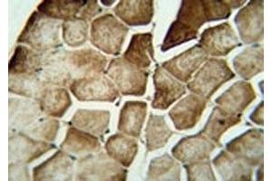 MAP1LC3A immunohistochemistry analysis in formalin fixed and paraffin embedded human skeletal muscle. (MAP1LC3A anticorps  (AA 100-125))