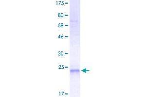 SDS-PAGE (SDS) image for Tumor Necrosis Factor (Ligand) Superfamily, Member 12 (TNFSF12) (AA 106-249) protein (His-DYKDDDDK-Strep II Tag) (ABIN4369884)