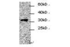 Image no. 1 for anti-Cell Division Cycle Associated 4 (CDCA4) antibody (ABIN791547)