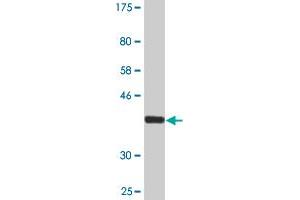Western Blot detection against Immunogen (37.