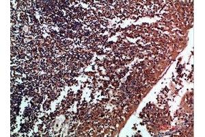 Immunohistochemical analysis of paraffin-embedded human-tonsil, antibody was diluted at 1:200 (Tenascin R anticorps  (AA 1270-1350))