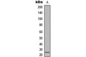 Western blot analysis of LT beta expression in human lymph node (A) whole cell lysates.