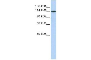 ATP11B antibody used at 1 ug/ml to detect target protein. (ATP11B anticorps  (N-Term))