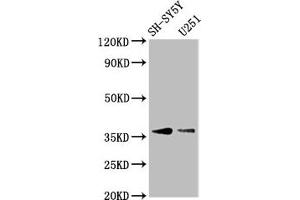 Western Blot Positive WB detected in: SH-SY5Y whole cell lysate, U251 whole cell lysate All lanes: BARHL1 antibody at 3. (BARHL1 anticorps  (AA 38-176))
