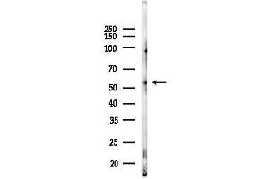 anti-Vitamin D-Binding Protein (GC) (Internal Region) antibody