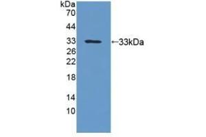 Detection of Recombinant UPb1, Human using Polyclonal Antibody to Beta-ureidopropionase (UPB1) (UPB1 anticorps  (AA 121-384))