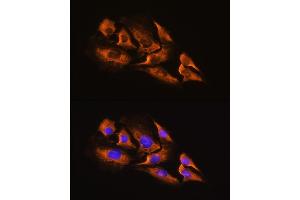 Immunofluorescence analysis of C6 cells using A Rabbit pAb (ABIN3016751, ABIN3016752, ABIN3016753 and ABIN6219833) at dilution of 1:100.