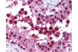 Anti-CUL9 / Cullin 9 antibody IHC of human testis.