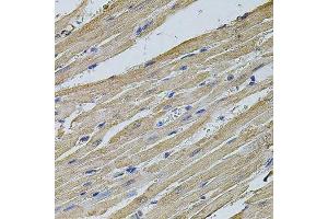 Immunohistochemistry of paraffin-embedded rat heart using EIF4A2 antibody. (EIF4A2 anticorps  (AA 1-270))